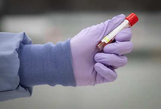 A hand in a purple glove holds a test tube with a red cap.